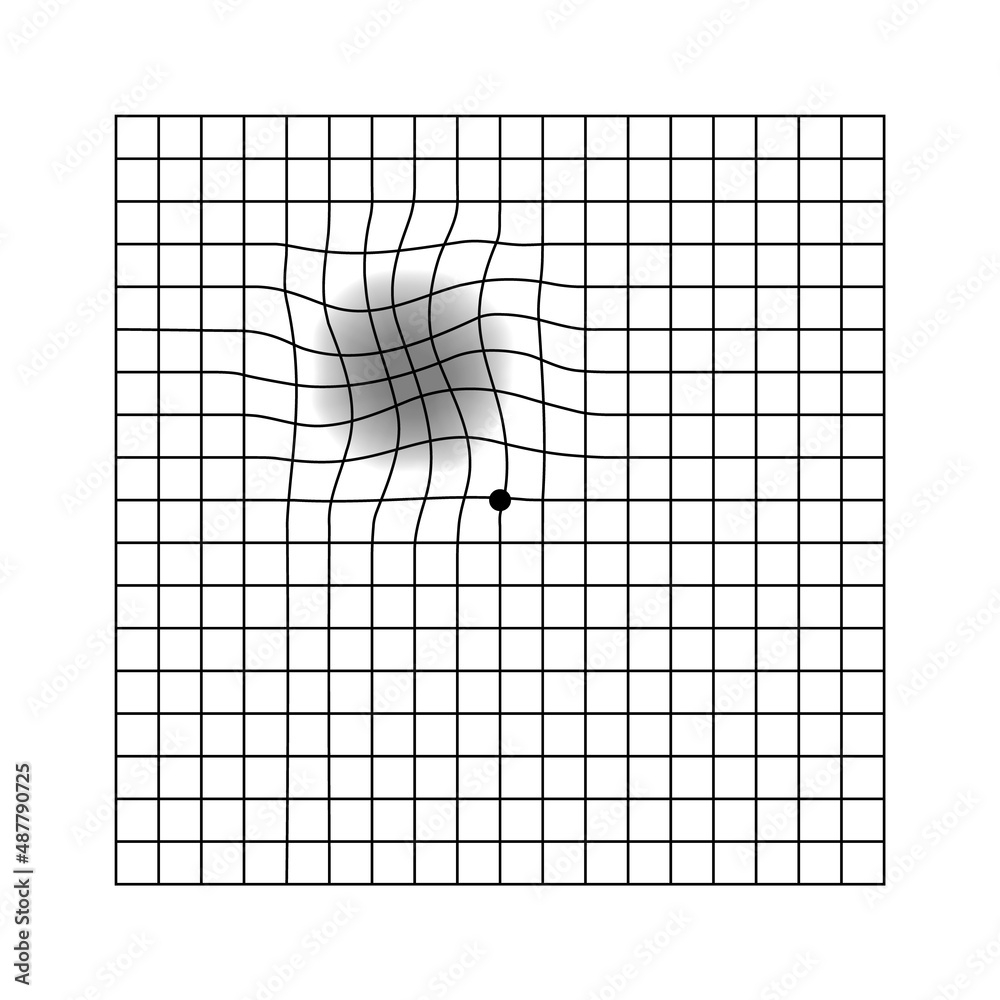 amsler grid printable